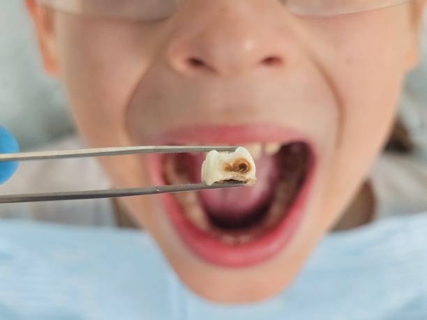 Professional Emergency Dental Service in ND