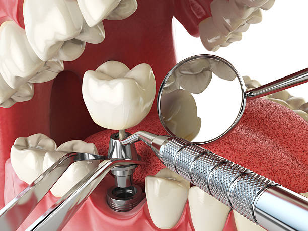 Best Emergency Orthodontic Repairs in Cao, ND
